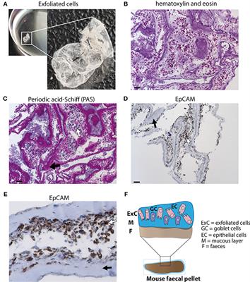 A Novel Non-invasive Method to Detect RELM Beta Transcript in Gut Barrier Related Changes During a Gastrointestinal Nematode Infection